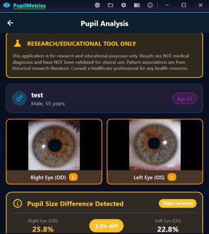 Static results with the research-tool disclaimer, both eye images graded C, and a pupil size difference card reading 25.8 versus 22.8 percent.