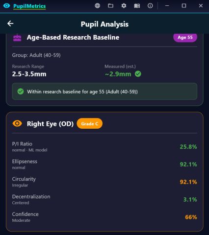 Static analysis results: age-based research baseline within range for age 55, and right eye metrics with grade C and 66 percent confidence.
