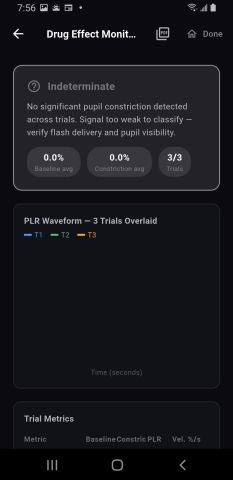 An indeterminate result: no significant pupil constriction detected across trials, signal too weak to classify, 0.0 percent baseline and constriction across 3 of 3 trials, above a three-trial waveform overlay.