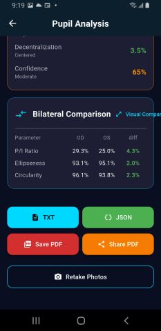 Android bilateral comparison and export row with TXT, JSON, Save PDF and Share PDF.