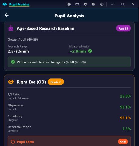 The age-based research baseline card reading within baseline for age 55, above the right eye panel with P/I ratio, ellipseness, circularity and decentralization.