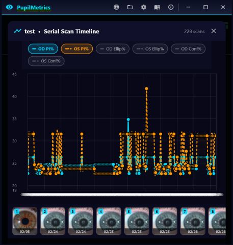 The serial scan timeline for one patient across 228 scans, with toggleable series for right and left eye P/I ratio, ellipseness and confidence, and a thumbnail strip of the underlying captures.