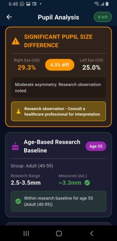 Android results showing a significant pupil size difference of 4.3 percent flagged as moderate asymmetry, above the age-based research baseline card.