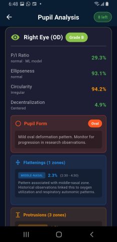 Android per-eye metrics with a grade B badge, a pupil form card reading mild oval deformation, and zone findings below.