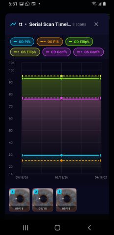The serial scan timeline on Android across three scans with six toggleable series.