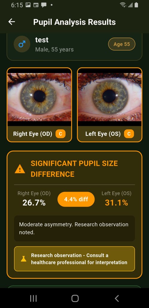 Both eyes, then the difference