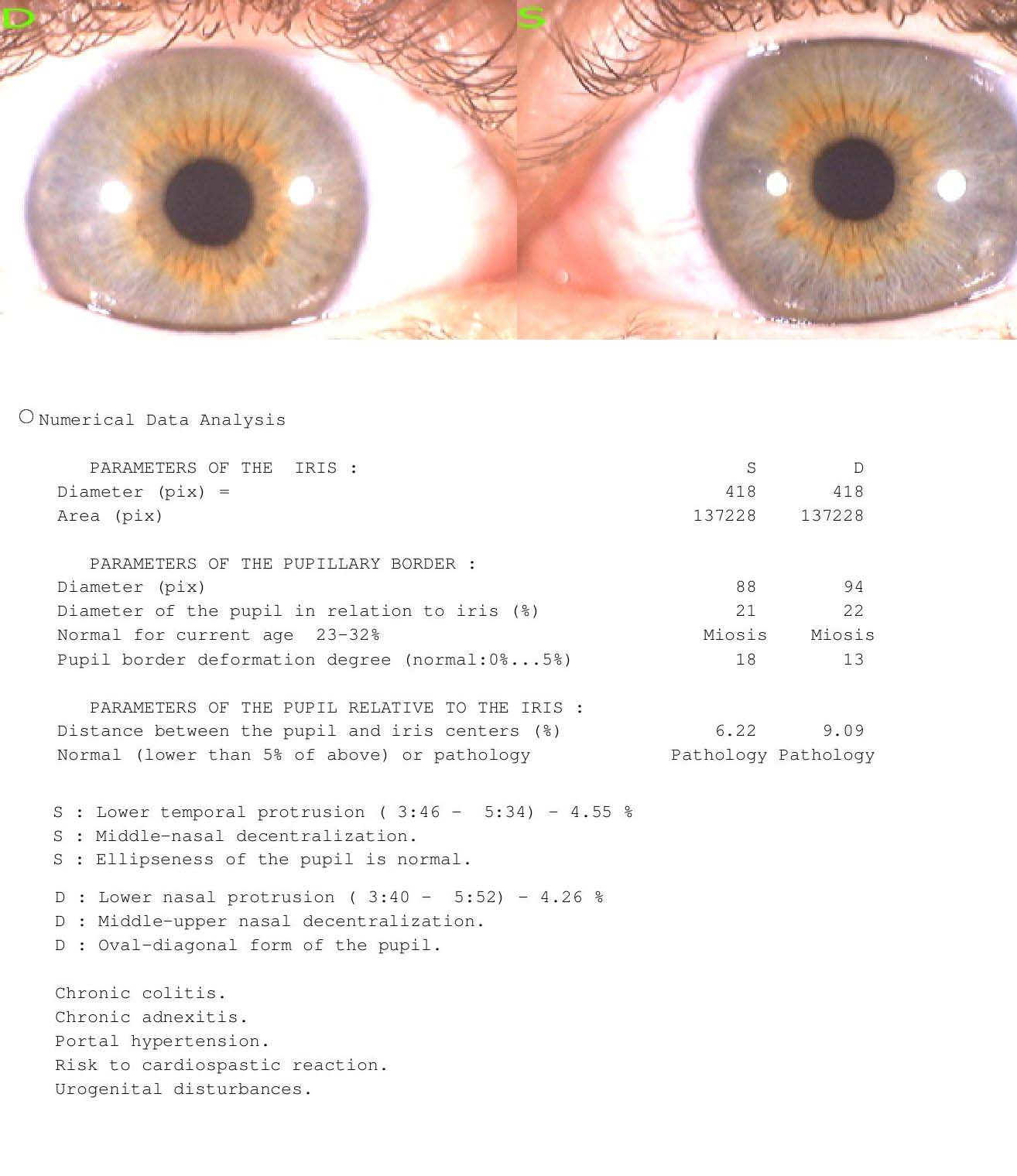 Neuro-Optic Assessment
