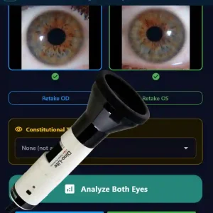 PupilMetrics Software with Dino-Lite Iriscope Package